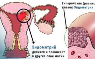 Характеристики неоднородного эндометрия – норма и патология