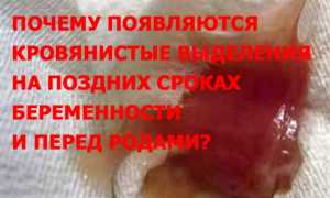 Кровянистые выделения во время беременности, насколько они опасны