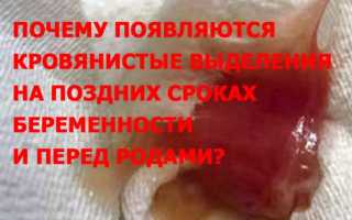 Кровянистые выделения во время беременности, насколько они опасны